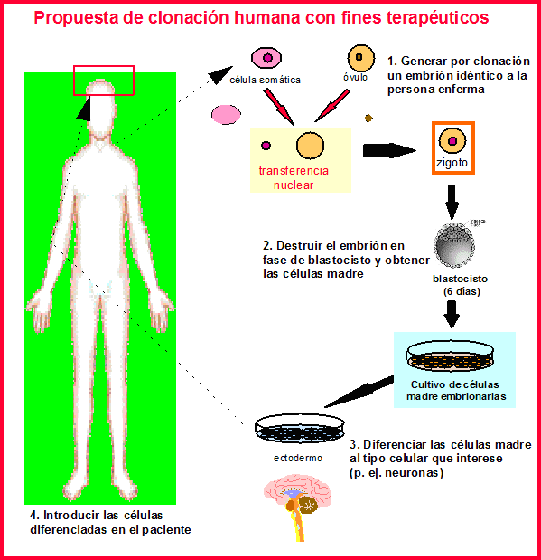 Mecanismos Moleculares de Diabetes: Clonación del cDNA del Mecanismos Moleculares de Diabetes: Clonación del cDNA del