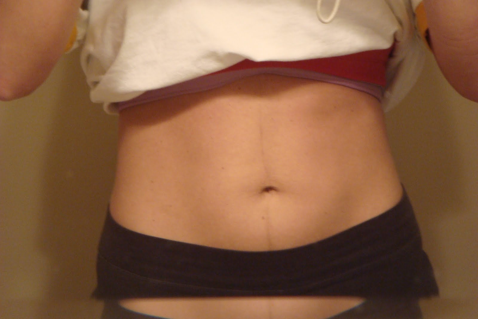 Postpartum Stomach Pictures