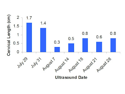 Cervical Length Chart In Twin Pregnancy By Weeks