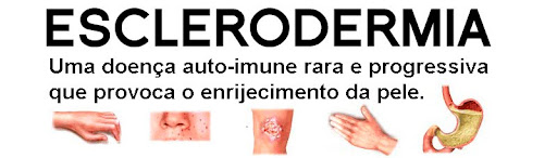 Esclerodermia