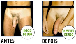 Aumentará um pênis