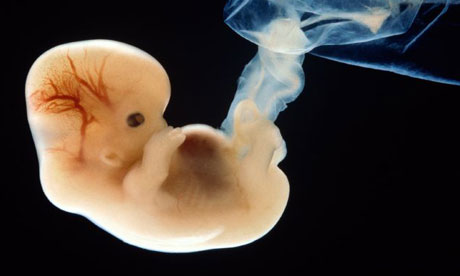 [human+embryo+2.jpg]