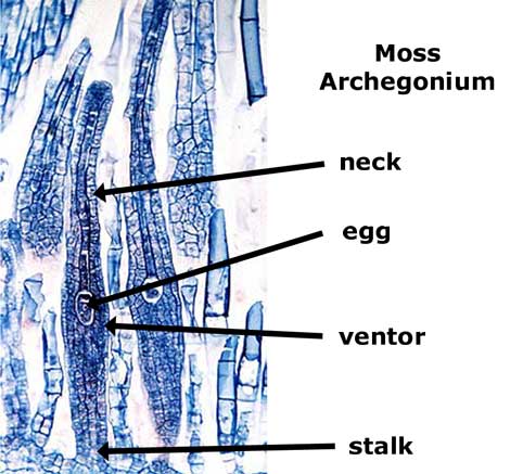 Polytrichum (Female Archegonia)