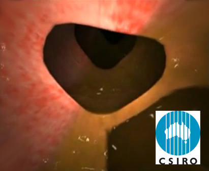 [csiro-colonoscopy-training-simulation.jpg]