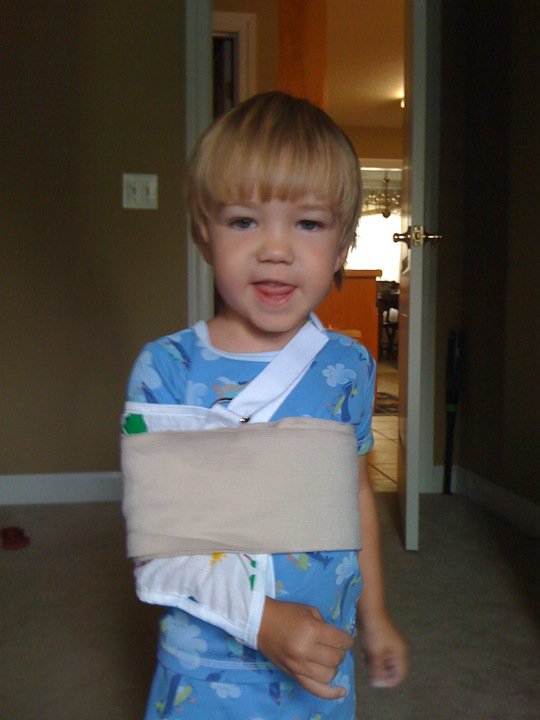 Time Out A Broken Collarbone and A Nursemaid Elbow