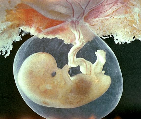 Created to be...HIS!: Baby "LEE" Update -- SIX WEEKS! Created to be...HIS!: Baby "LEE" Update -- SIX WEEKS!