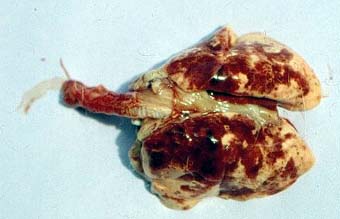 [اصابة+الرئتين+1.jpg]