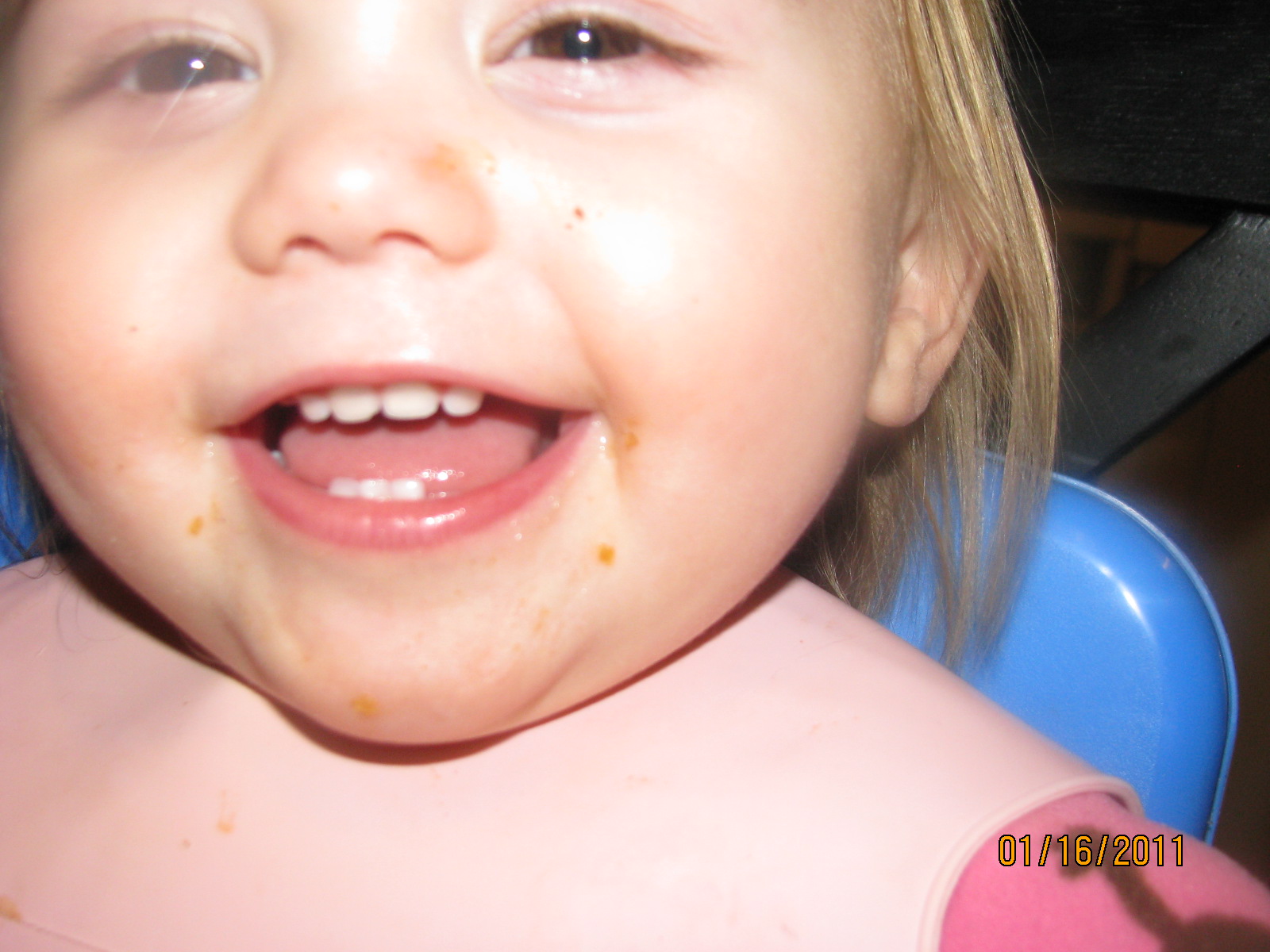 Chipped Baby Tooth
