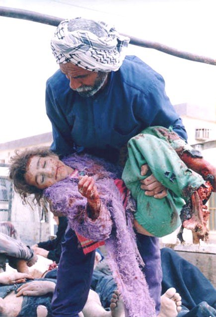 [bloodied_iraq_child.jpg]
