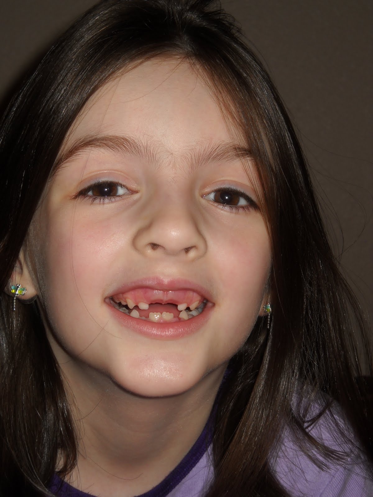 From Tracie How Fast Teeth Grow