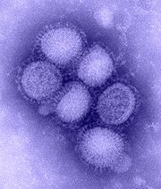 [180px-H1N1_influenza_virus.jpg]