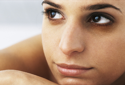 Dark circles under the eyes