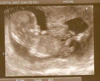 Bebe 13 Semanas