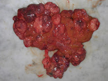 Cirrosis hepática (canino)