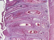 Metaplasia escamosa (utero, oveja)