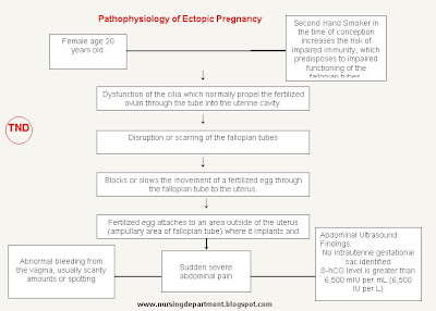 ectopic pregnancy pathophysiology