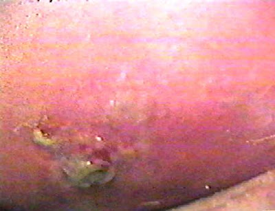 ���������� ����� ����������