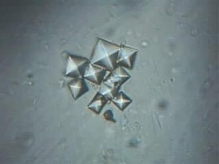 Urine Under Microscope