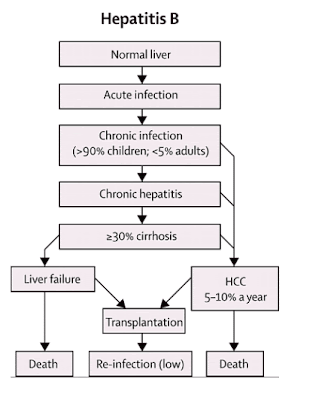 The Hepatitis B vaccine is