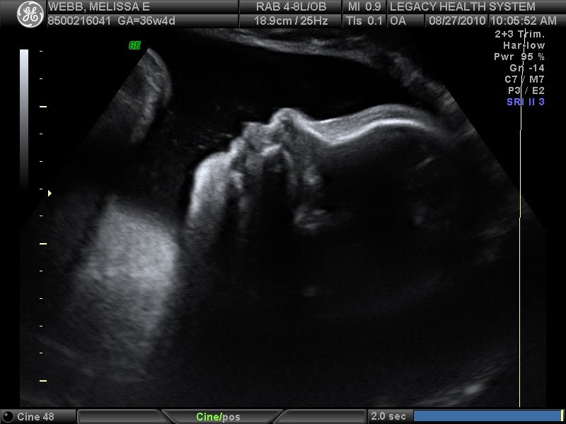 Waiting for our 2nd Little Webb: De Ja Vu - 36 weeks