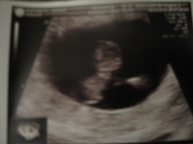 Our love continues to grow as we find out Baby 3 (Baby 1 was miscarried 4/17/08) is on the way