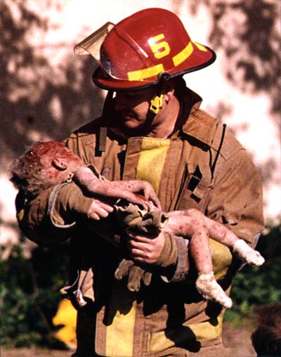 The image of firefighter Chris Fields holding the dying infant Baylee Almon won the Pulitzer Prize