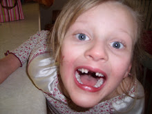 Kelsey Lost Her Two Front Teeth