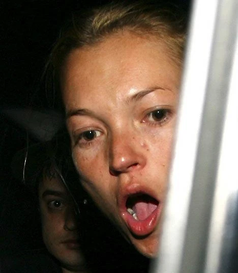Is Pete ruining Kate Moss's looks?