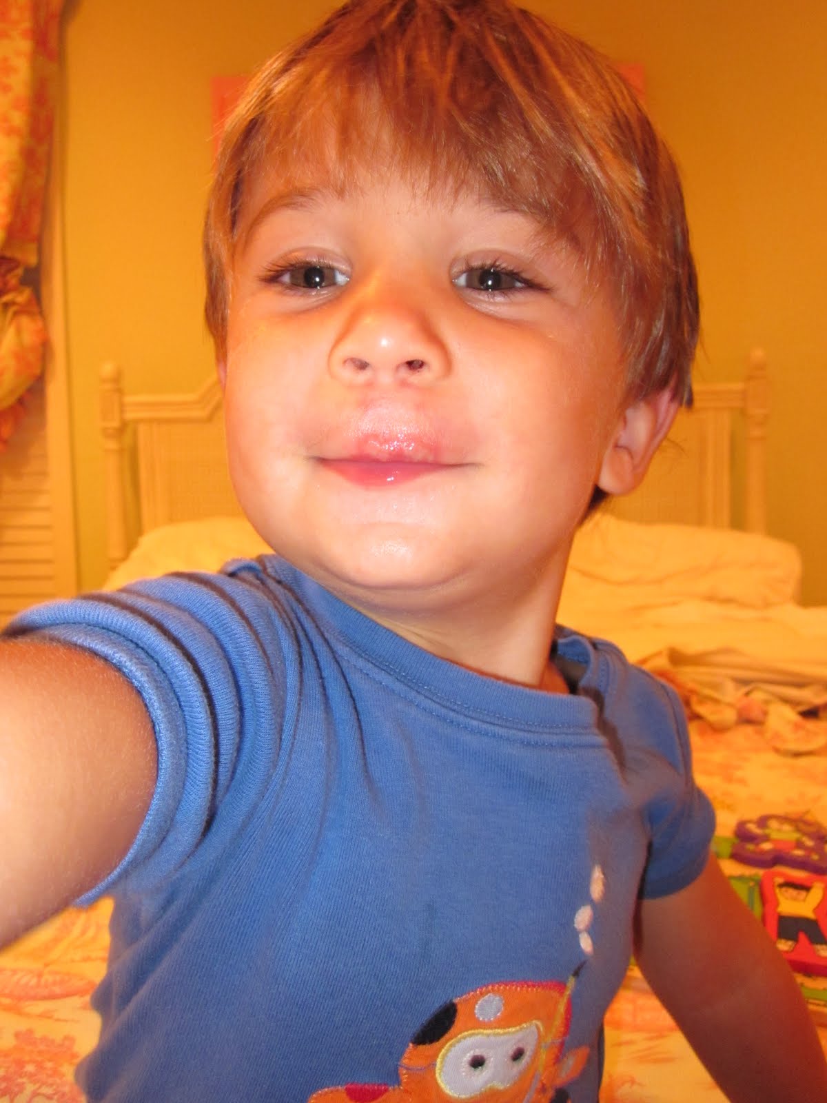 the dunn's 1st Busted Lip