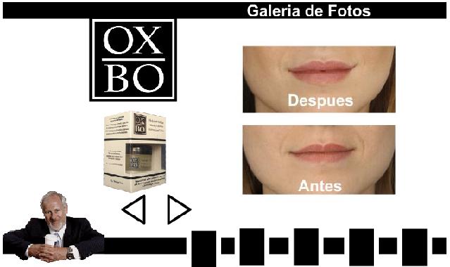 OXBO REDUCE LINEAS DE EXPRESION