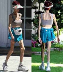 [aorexia.bmp]