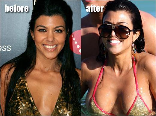 selena gomez breast implants. selena gomez breast photos. selena gomez breast implants.