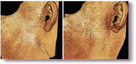 [faceliftBloodSupply.jpg]