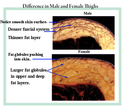 [cellulite-SFS8.jpg]