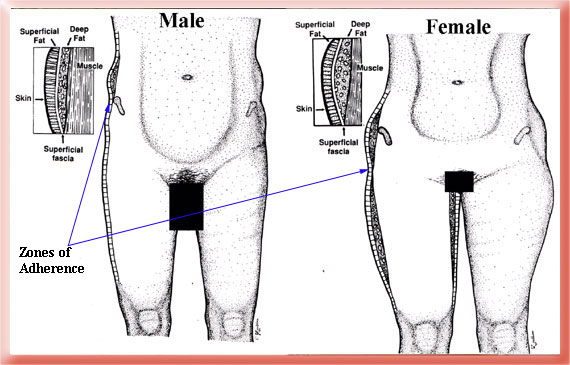 [cellulite-SFS.jpg]
