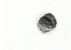 The pistol ball that was removed from Lincoln's head