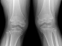Tulang rawan pada kaki - 15 Fakta Menarik Tentang Tubuh Kita - Simbya
