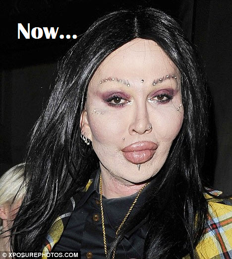 pete burns before and after. Pete was married to a woman