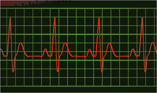 PULSE