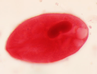 Balantidium Coli Trophozoite
