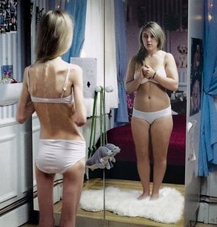 [anorexia.jpg]