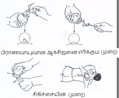 [cupping-techniques.jpg]