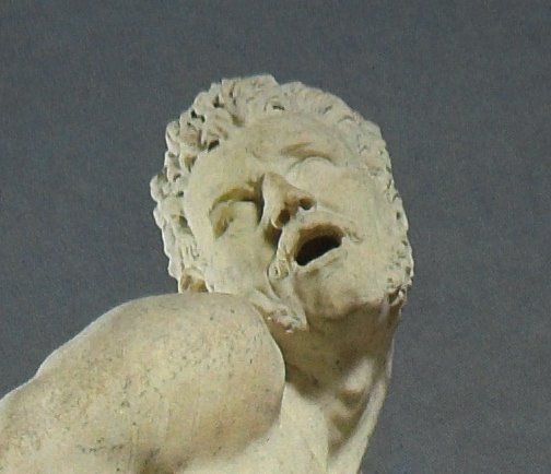 [detail-understatement-1a.jpg]