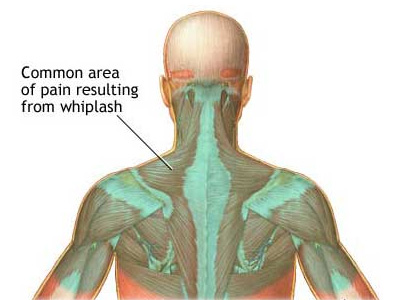 [_0031whippit.jpg]