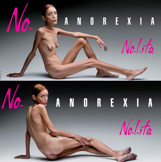 [anorexia.jpg]
