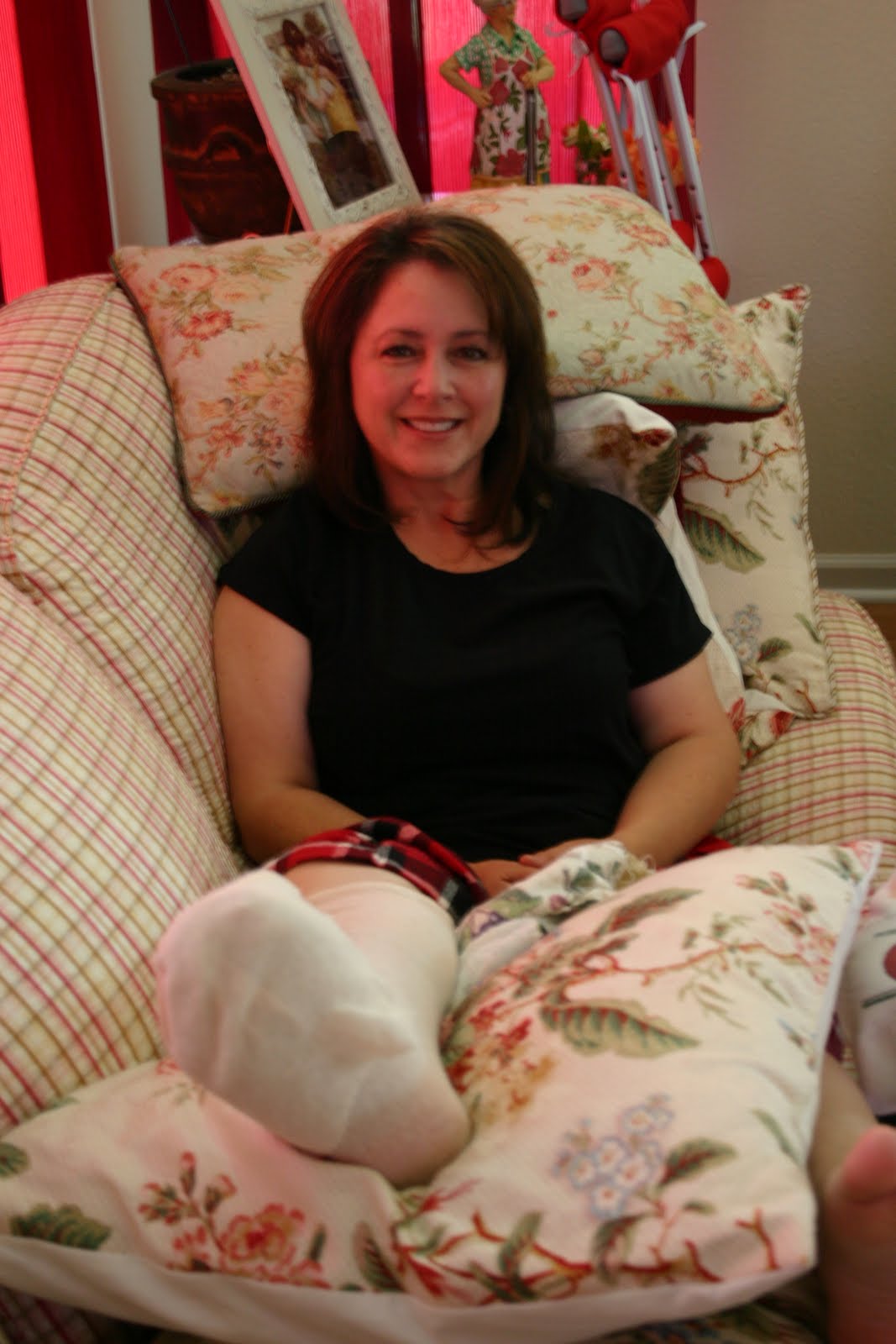 mcbride bunionectomy