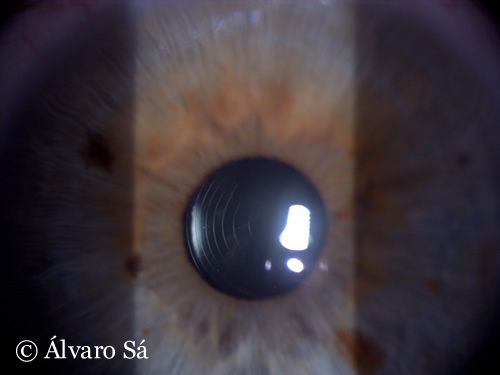 [1BH3VCTE1SPR8A68_Restor_00.JPG]