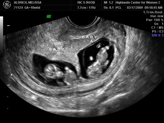 [BABY_4.JPG]