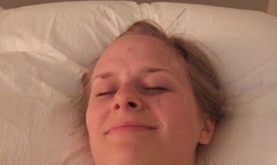 Needles In Head