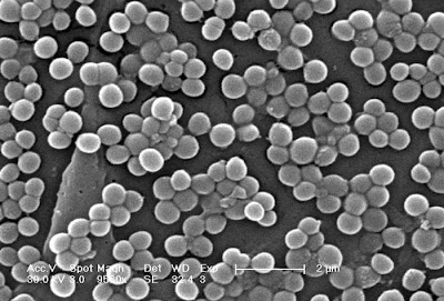 耐甲氧西林金黃色葡萄球菌(MRSA) 超級細菌--抗生素的末日